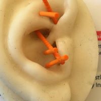 NADA needles in model ear